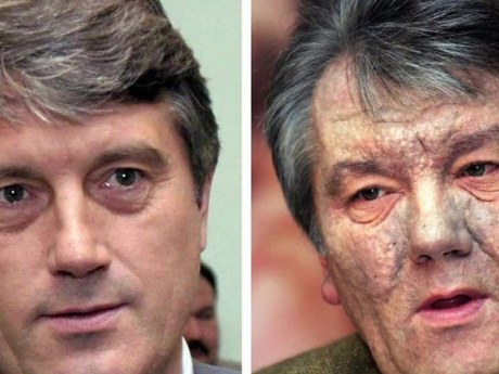 Балога заявив про нову версію отруєння Ющенка та роль оточення